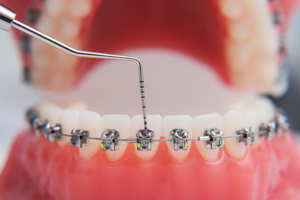 orthodontic img (2)
