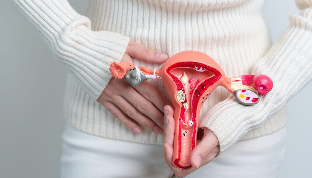 ovarian cysts treatment in dubai