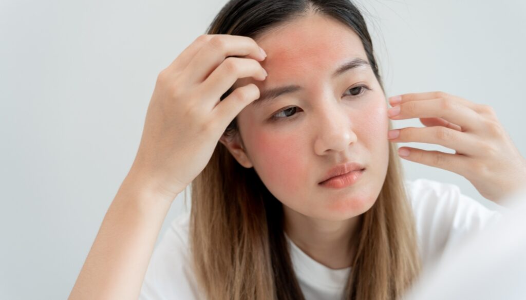 Dermatitis treatment
