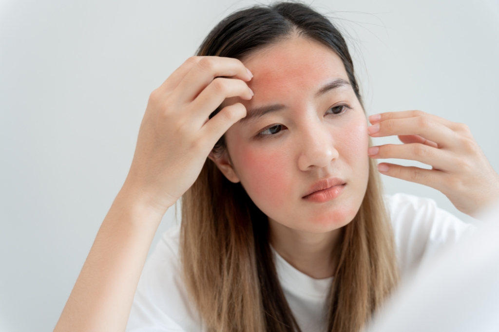 Dermatitis treatment