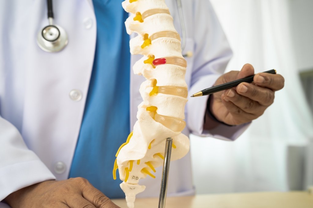 herniated disc treatment Dubai