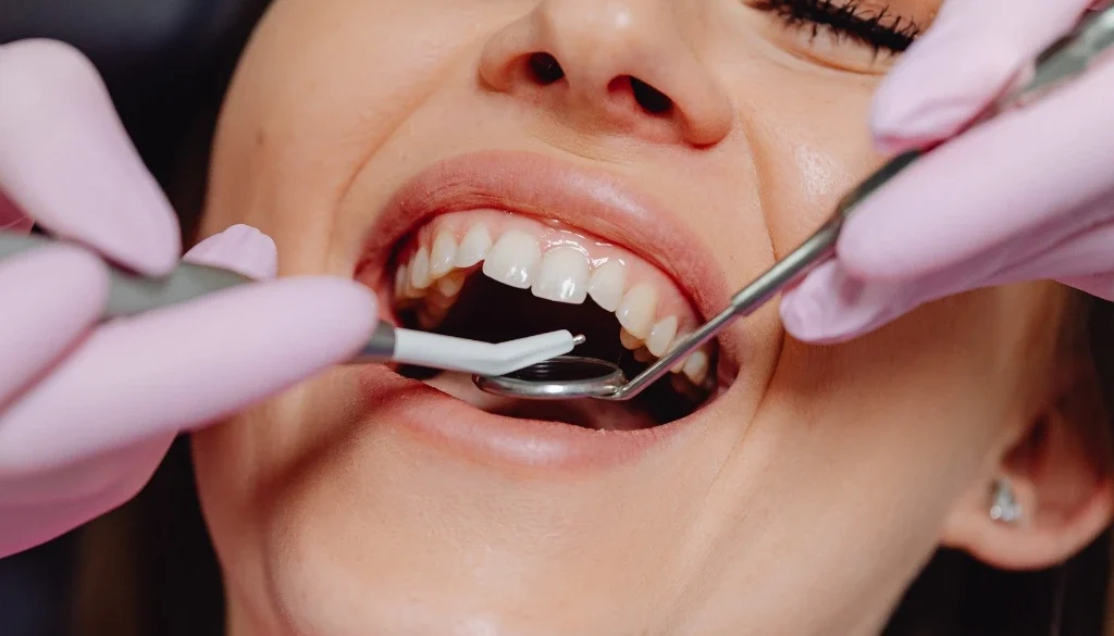 deep cleaning teeth