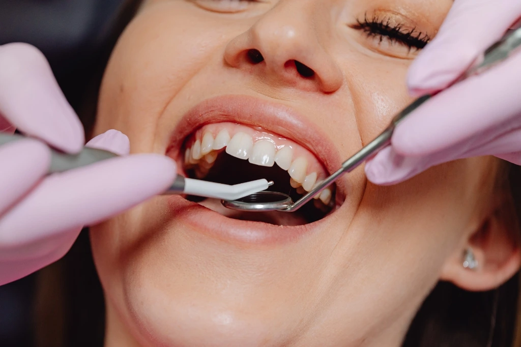 deep cleaning teeth