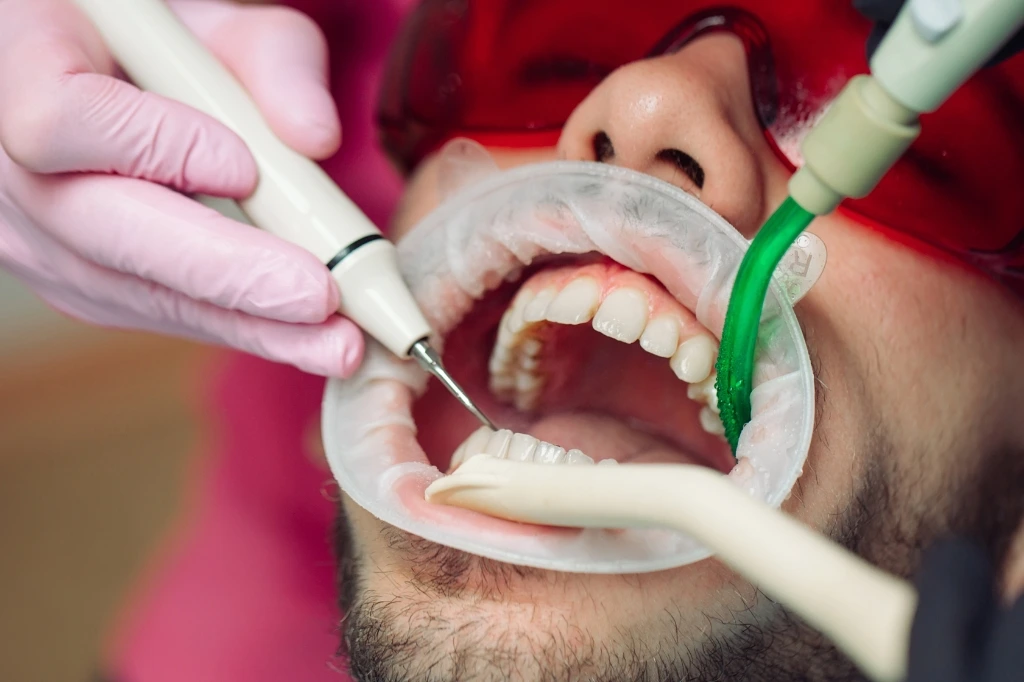 teeth cleaning dubai