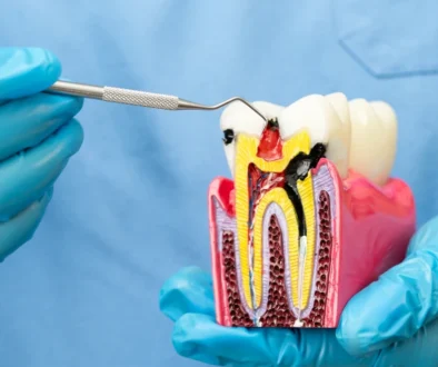 root canal specialist Dubai