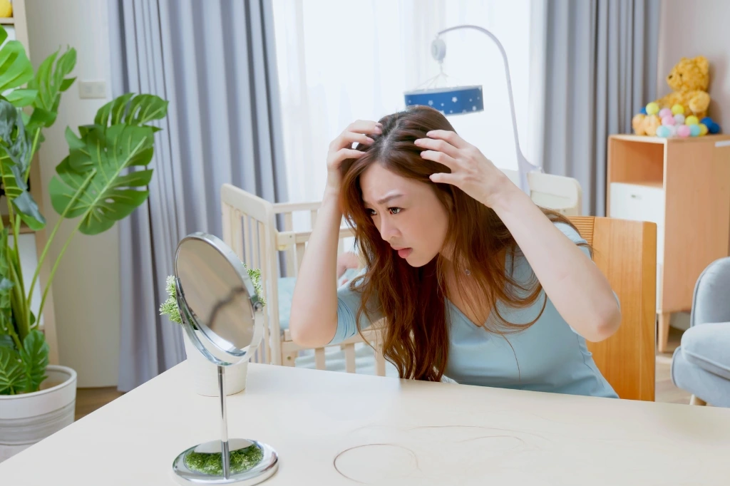 post natal hair loss