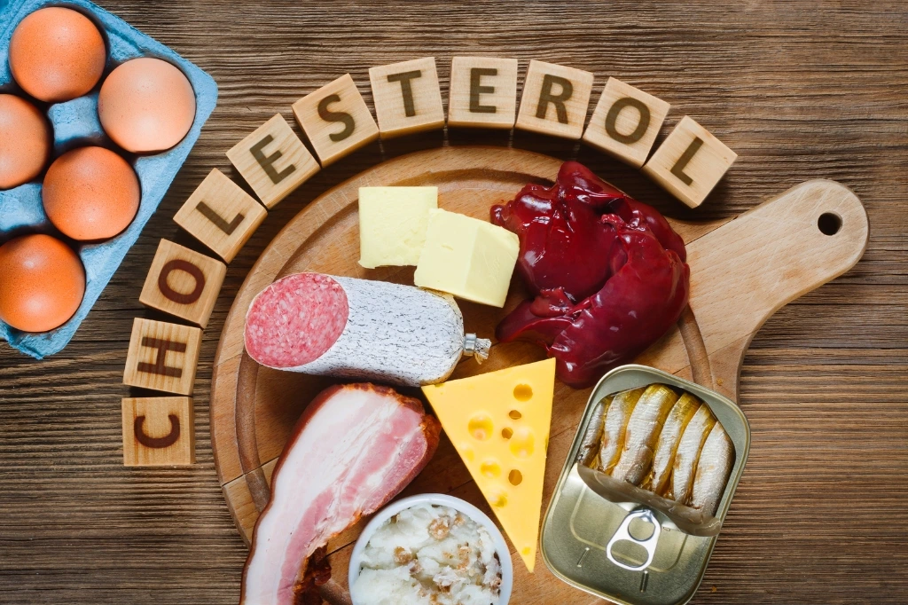 High Cholesterol Treatment