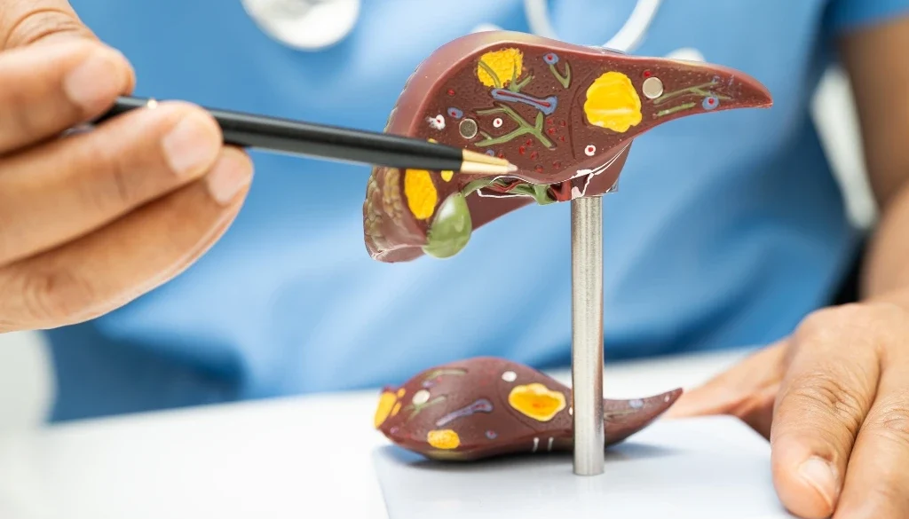 fatty liver disease treatment in Dubai