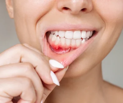 periodontist in dubai