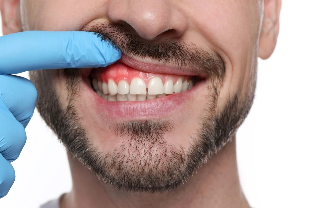 gum specialist in dubai